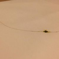 piece of hair DD found in her Saag Paneer at Madras Ananda Bhavan in Phoenix