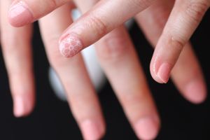 Lace art at Line Spa and Polish in Vancouver