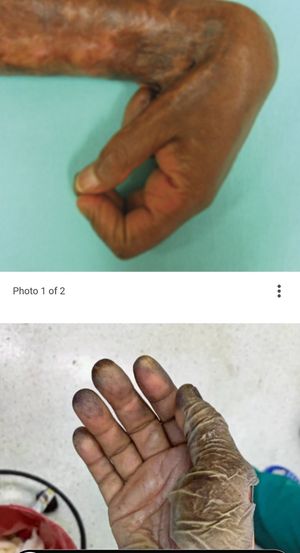  at Saravanaa Bhavan - Sankt Eriksgatan in Stockholm