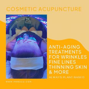 Facial rejuvenation acupuncture  at PNW Cosmetic Acupuncture in Seattle