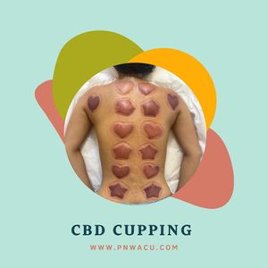 CBD Cupping  at PNW Cosmetic Acupuncture in Seattle
