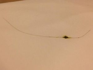 piece of hair DD found in her Saag Paneer at Madras Ananda Bhavan in Phoenix