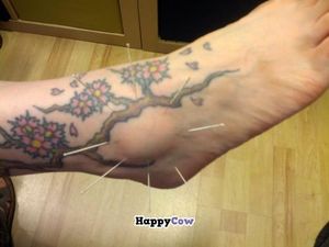 Acupuncuture for damaged joints, not too painful at El Druida y Las Hierbas in Palencia