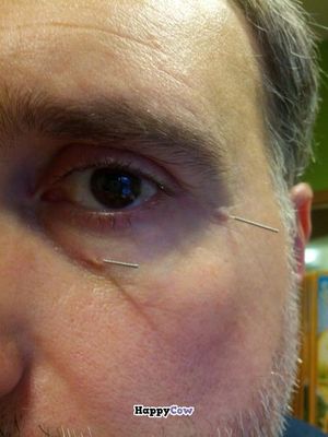 More on accupuncture at El Druida y Las Hierbas in Palencia