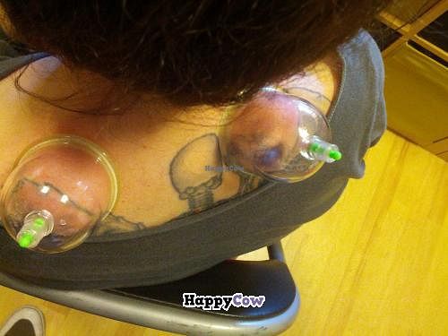 Cups treatment, weird but extremely effective at El Druida y Las Hierbas in Palencia